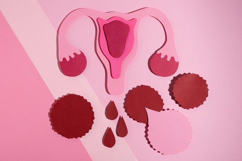 Vulvar Varicosities